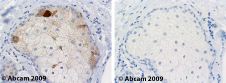 Immunohistochemistry (Formalin/PFA-fixed paraffin-embedded sections) - Anti-SCD1 antibody [CD.E10] (AB19862)