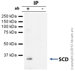 Immunoprecipitation - Anti-SCD1 antibody [CD.E10] (AB19862)