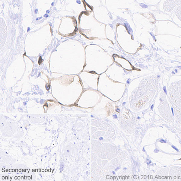 Immunohistochemistry (Formalin/PFA-fixed paraffin-embedded sections) - Anti-SCD1 antibody [EPR21963] (AB236868), expandable thumbnail