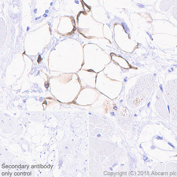 Immunohistochemistry (Formalin/PFA-fixed paraffin-embedded sections) - Anti-SCD1 antibody [EPR21963] (AB236868)