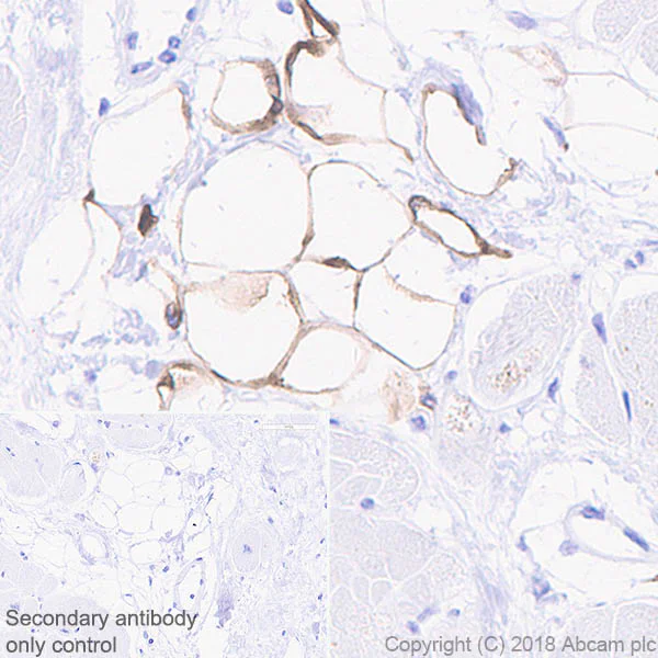 Immunohistochemistry (Formalin/PFA-fixed paraffin-embedded sections) - Anti-SCD1 antibody [EPR21963] - BSA and Azide free (AB238171)