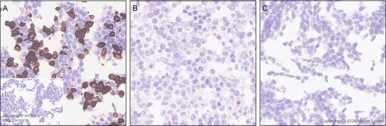 Immunohistochemistry (Formalin/PFA-fixed paraffin-embedded sections) - Anti-SCD5 antibody [MJF-D29765-175] (AB327055)