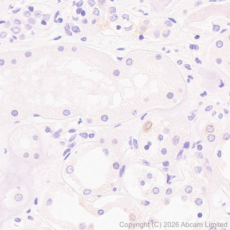 Immunohistochemistry (Formalin/PFA-fixed paraffin-embedded sections) - Anti-SCD5 antibody [MJF-D29765-175] - BSA and Azide free (AB327062)