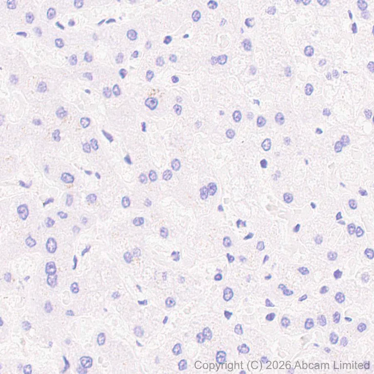 Immunohistochemistry (Formalin/PFA-fixed paraffin-embedded sections) - Anti-SCD5 antibody [MJF-D29765-175] - BSA and Azide free (AB327062)