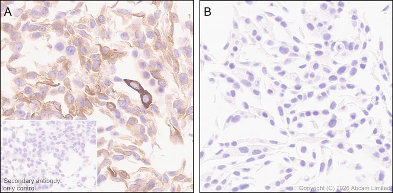 Immunohistochemistry (Formalin/PFA-fixed paraffin-embedded sections) - Anti-SCD5 antibody [MJF-D29765-175] - BSA and Azide free (AB327062)