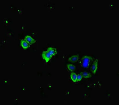 Immunocytochemistry/ Immunofluorescence - Anti-SCDGFB/PDGF-D antibody (AB234666)