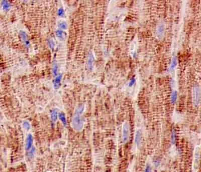 Immunohistochemistry (Formalin/PFA-fixed paraffin-embedded sections) - Anti-SCDGFB/PDGF-D antibody [EPR7266(2)] (AB181845)