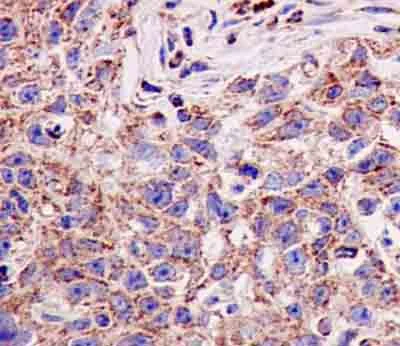 Immunohistochemistry (Formalin/PFA-fixed paraffin-embedded sections) - Anti-SCDGFB/PDGF-D antibody [EPR7266(2)] (AB181845)