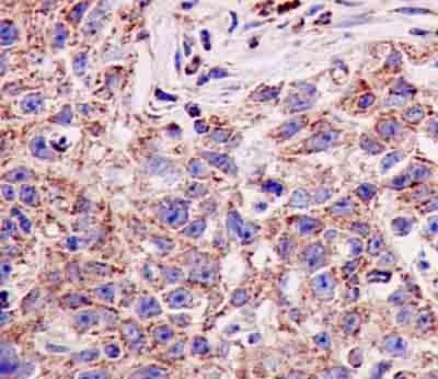 Immunohistochemistry (Formalin/PFA-fixed paraffin-embedded sections) - Anti-SCDGFB/PDGF-D antibody [EPR7266(2)] - BSA and Azide free (AB240960)