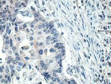 Immunohistochemistry (Formalin/PFA-fixed paraffin-embedded sections) - Anti-SCEL antibody (AB197087), expandable thumbnail