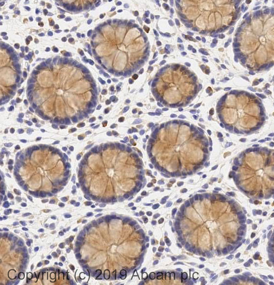 Immunohistochemistry (Formalin/PFA-fixed paraffin-embedded sections) - Anti-SCF antibody (AB64677), expandable thumbnail