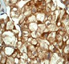 Immunohistochemistry (Formalin/PFA-fixed paraffin-embedded sections) - Anti-SCF antibody [EP665Y] (AB52603), expandable thumbnail