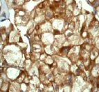 Immunohistochemistry (Formalin/PFA-fixed paraffin-embedded sections) - Anti-SCF antibody [EP665Y] (AB52603)