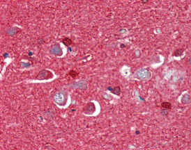 Immunohistochemistry (Formalin/PFA-fixed paraffin-embedded sections) - Anti-SCG10 antibody (AB115513)