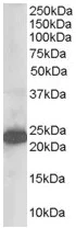 Western blot - Anti-SCG10 antibody (AB21190)