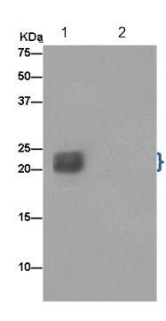Immunoprecipitation - Anti-SCG10 antibody [EPR15286-39] (AB185956)