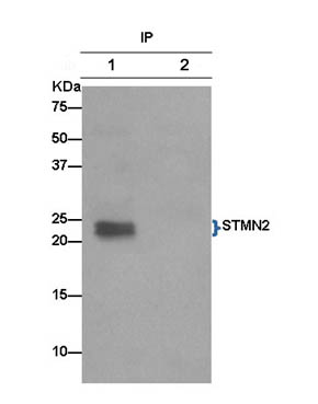 Immunoprecipitation - Anti-SCG10 antibody [EPR15286] (AB185943), expandable thumbnail