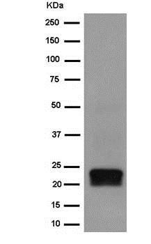Western blot - Anti-SCG10 antibody [EPR15286] (AB185943), expandable thumbnail