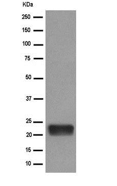 Western blot - Anti-SCG10 antibody [EPR15286] (AB185943), expandable thumbnail