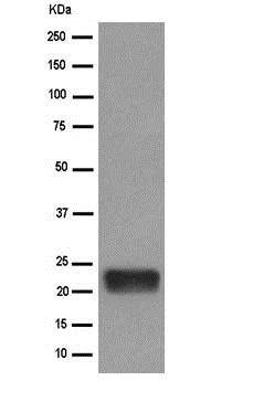 Western blot - Anti-SCG10 antibody [EPR15286] (AB185943)