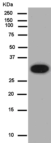 Western blot - Anti-SCGB3A2 antibody [EPR11463] (AB181853)