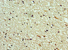 Immunohistochemistry (Formalin/PFA-fixed paraffin-embedded sections) - Anti-SCGF antibody (AB238830)