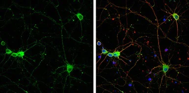 Immunocytochemistry/ Immunofluorescence - Anti-SCGN/Secretagogin antibody (AB111871)