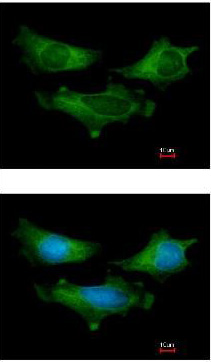 Immunocytochemistry/ Immunofluorescence - Anti-SCGN/Secretagogin antibody (AB111871), expandable thumbnail
