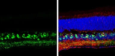 Immunohistochemistry (Frozen sections) - Anti-SCGN/Secretagogin antibody (AB111871)