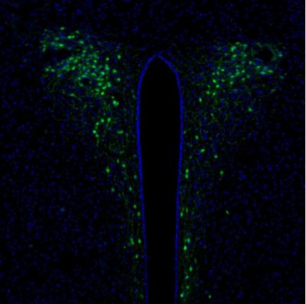 Immunohistochemistry (Formalin/PFA-fixed paraffin-embedded sections) - Anti-SCGN/Secretagogin antibody (AB211362), expandable thumbnail