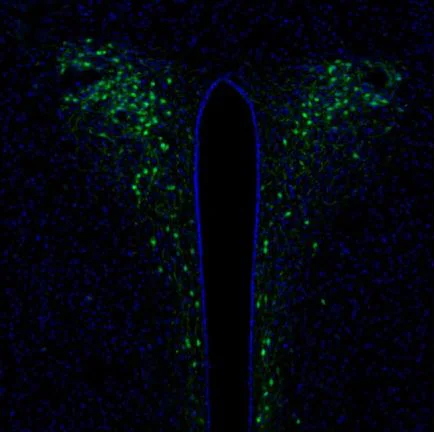 Immunohistochemistry (Formalin/PFA-fixed paraffin-embedded sections) - Anti-SCGN/Secretagogin antibody (AB211362)