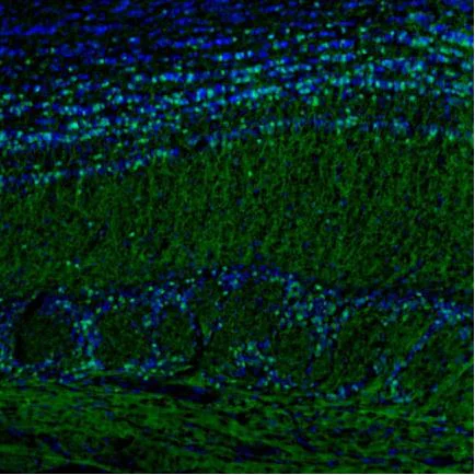Immunohistochemistry (Formalin/PFA-fixed paraffin-embedded sections) - Anti-SCGN/Secretagogin antibody (AB211362)
