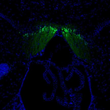 Immunohistochemistry (Formalin/PFA-fixed paraffin-embedded sections) - Anti-SCGN/Secretagogin antibody (ab211362), expandable thumbnail