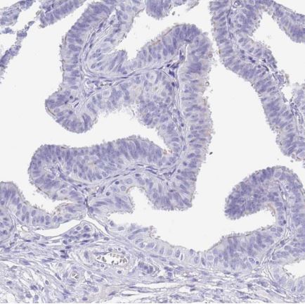 Immunohistochemistry (Formalin/PFA-fixed paraffin-embedded sections) - Anti-SCGN/Secretagogin antibody (ab211362), expandable thumbnail