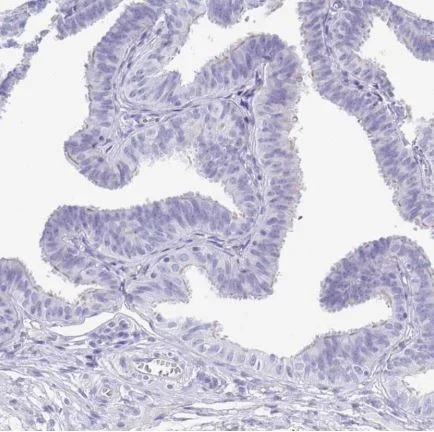 Immunohistochemistry (Formalin/PFA-fixed paraffin-embedded sections) - Anti-SCGN/Secretagogin antibody (AB211362)