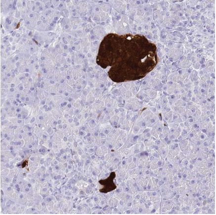 Immunohistochemistry (Formalin/PFA-fixed paraffin-embedded sections) - Anti-SCGN/Secretagogin antibody (AB211362), expandable thumbnail