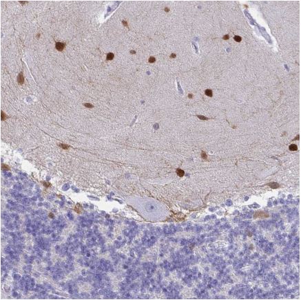 Immunohistochemistry (Formalin/PFA-fixed paraffin-embedded sections) - Anti-SCGN/Secretagogin antibody (AB211362), expandable thumbnail