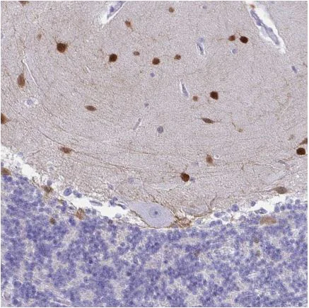 Immunohistochemistry (Formalin/PFA-fixed paraffin-embedded sections) - Anti-SCGN/Secretagogin antibody (AB211362)