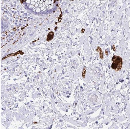 Immunohistochemistry (Formalin/PFA-fixed paraffin-embedded sections) - Anti-SCGN/Secretagogin antibody (ab211362), expandable thumbnail