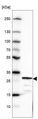 Western blot - Anti-SCGN/Secretagogin antibody (AB211362), expandable thumbnail