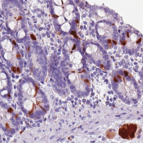 Immunohistochemistry (Formalin/PFA-fixed paraffin-embedded sections) - Anti-SCGN/Secretagogin antibody [CL0271] (AB244219)