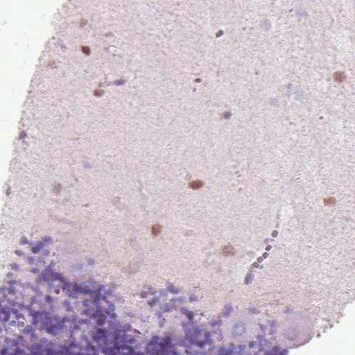 Immunohistochemistry (Formalin/PFA-fixed paraffin-embedded sections) - Anti-SCGN/Secretagogin antibody [CL0271] (AB244219)