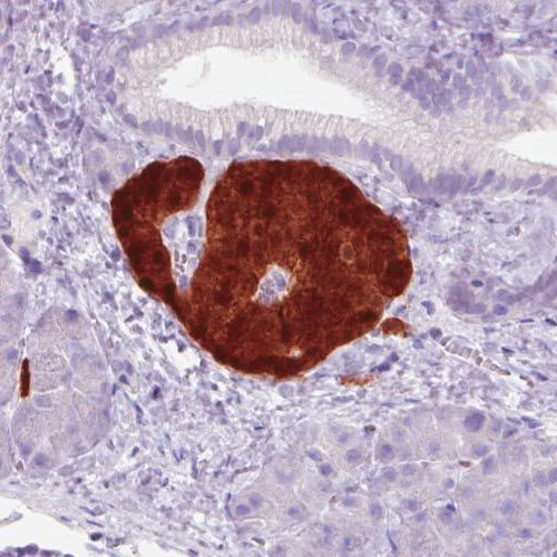 Immunohistochemistry (Formalin/PFA-fixed paraffin-embedded sections) - Anti-SCGN/Secretagogin antibody [CL0271] (AB244219)