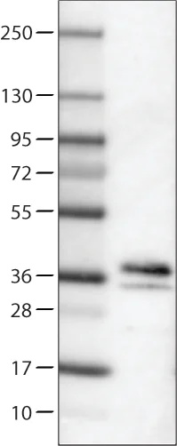 Western blot - Anti-SCGN/Secretagogin antibody [CL0271] (AB244219)