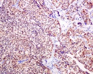 Immunohistochemistry (Formalin/PFA-fixed paraffin-embedded sections) - Anti-SCGN/Secretagogin antibody [EPR7476] (AB138493)