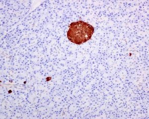 Immunohistochemistry (Formalin/PFA-fixed paraffin-embedded sections) - Anti-SCGN/Secretagogin antibody [EPR7476] (AB138493)