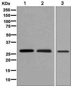 Western blot - Anti-SCGN/Secretagogin antibody [EPR7476] (AB138493)