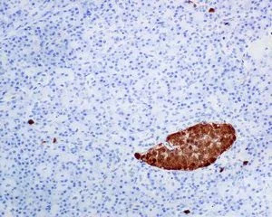 Immunohistochemistry (Formalin/PFA-fixed paraffin-embedded sections) - Anti-SCGN/Secretagogin antibody [EPR7477] - BSA and Azide free (AB248768)