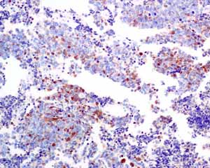 Immunohistochemistry (Formalin/PFA-fixed paraffin-embedded sections) - Anti-SCGN/Secretagogin antibody [EPR7477] - BSA and Azide free (AB248768), expandable thumbnail