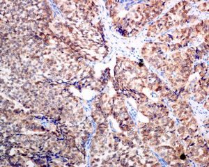 Immunohistochemistry (Formalin/PFA-fixed paraffin-embedded sections) - Anti-SCGN/Secretagogin antibody [EPR7477] - BSA and Azide free (AB248768), expandable thumbnail